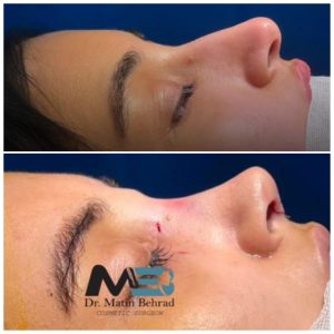 کلینیک زیبایی دکتر متین بهراد در گیلان،کلینیک زیبایی دکتر متین بهراد گیلان،مشاهده اطلاعات کلینیک زیبایی دکتر متین بهراد در گیلان در سامانه برترین مشاغل