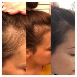 مرکز سلامت مو و ریشه هامین قزوین