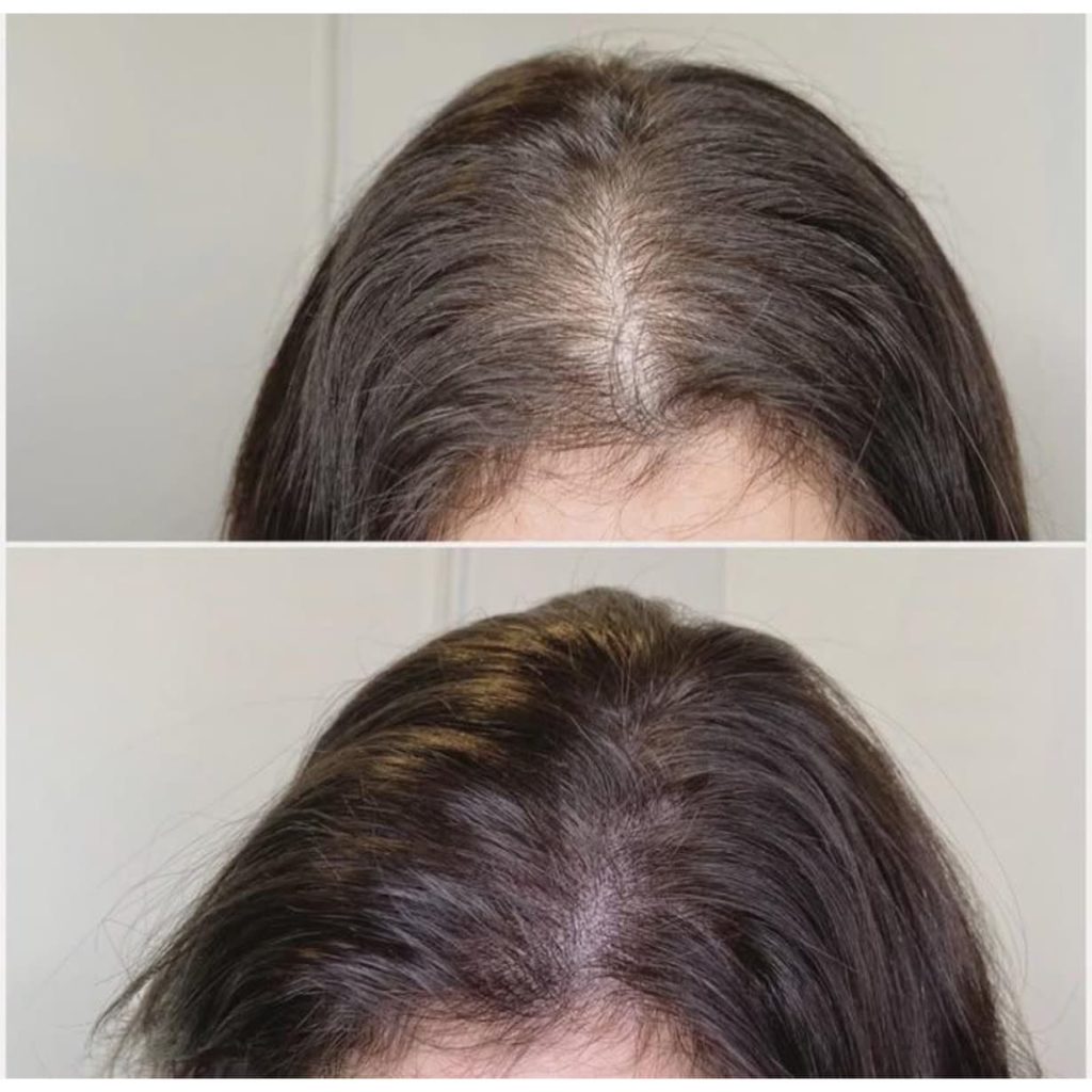 مرکز سلامت مو و ریشه هامین قزوین