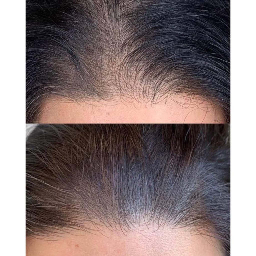 مرکز سلامت مو و ریشه هامین قزوین