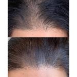 مرکز سلامت مو و ریشه هامین قزوین