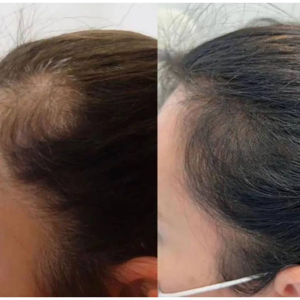 مرکز سلامت مو و ریشه هامین قزوین