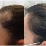 مرکز سلامت مو و ریشه هامین قزوین