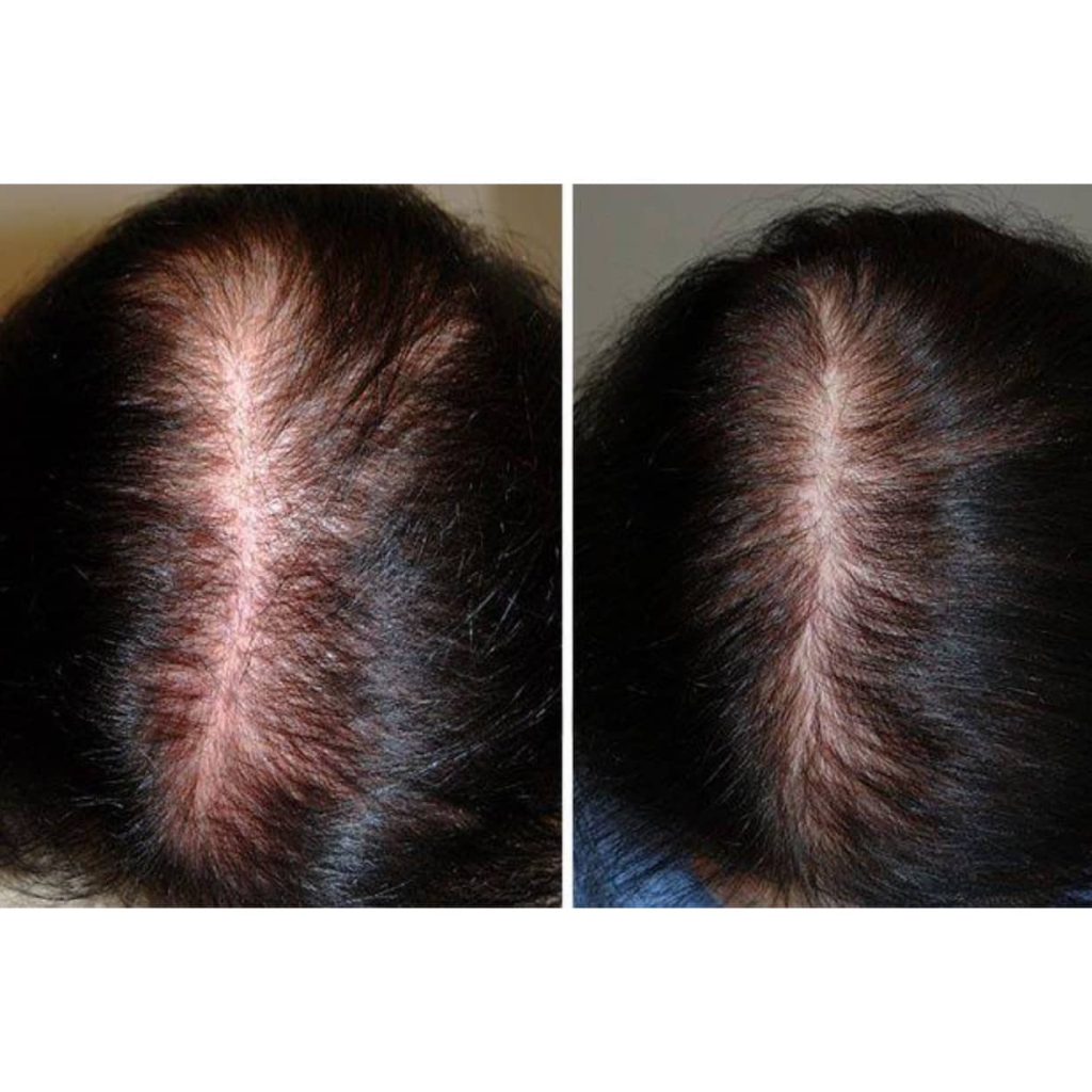 مرکز سلامت مو و ریشه هامین قزوین