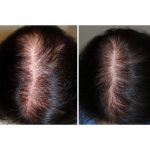 مرکز سلامت مو و ریشه هامین قزوین