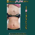 کلینیک تغذیه سعیدی میبد