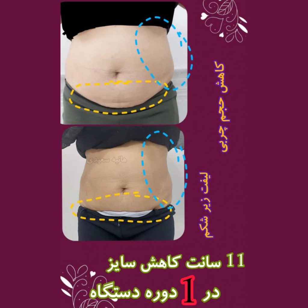 کلینیک تغذیه سعیدی میبد