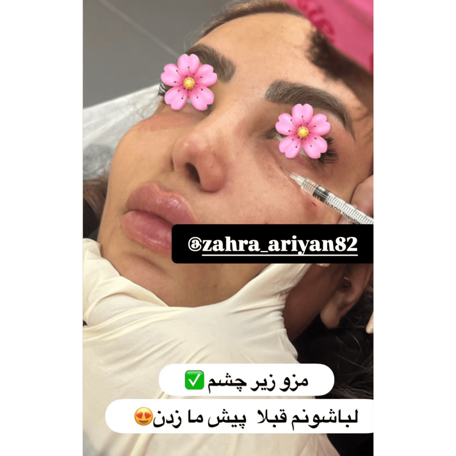 سالن ژل و بوتاکس زهرا آرین خرم آباد،سالن ژل و بوتاکس زهرا آرین در خرم آباد،مشاهده اطلاعات سالن ژل و بوتاکس زهرا آرین خرم آباد در سامانه برترین مشاغل