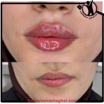 سالن ژل و بوتاکس زهرا آرین خرم آباد