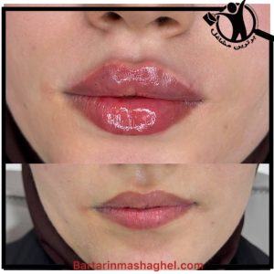 سالن ژل و بوتاکس زهرا آرین خرم آباد،سالن ژل و بوتاکس زهرا آرین در خرم آباد،مشاهده اطلاعات سالن ژل و بوتاکس زهرا آرین خرم آباد در سامانه برترین مشاغل