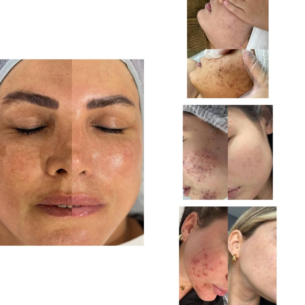 سالن ژل و بوتاکس زهرا آرین خرم آباد