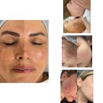 سالن ژل و بوتاکس زهرا آرین خرم آباد