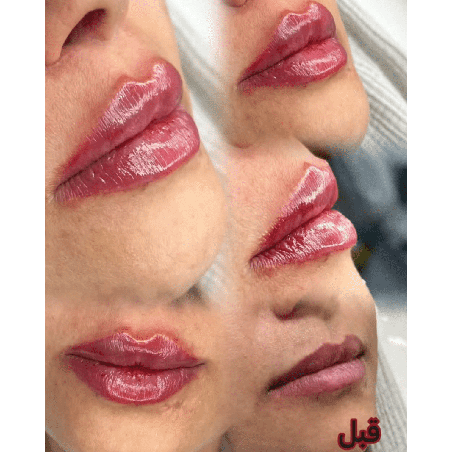 سالن ژل و بوتاکس زهرا آرین خرم آباد،سالن ژل و بوتاکس زهرا آرین در خرم آباد،مشاهده اطلاعات سالن ژل و بوتاکس زهرا آرین خرم آباد در سامانه برترین مشاغل