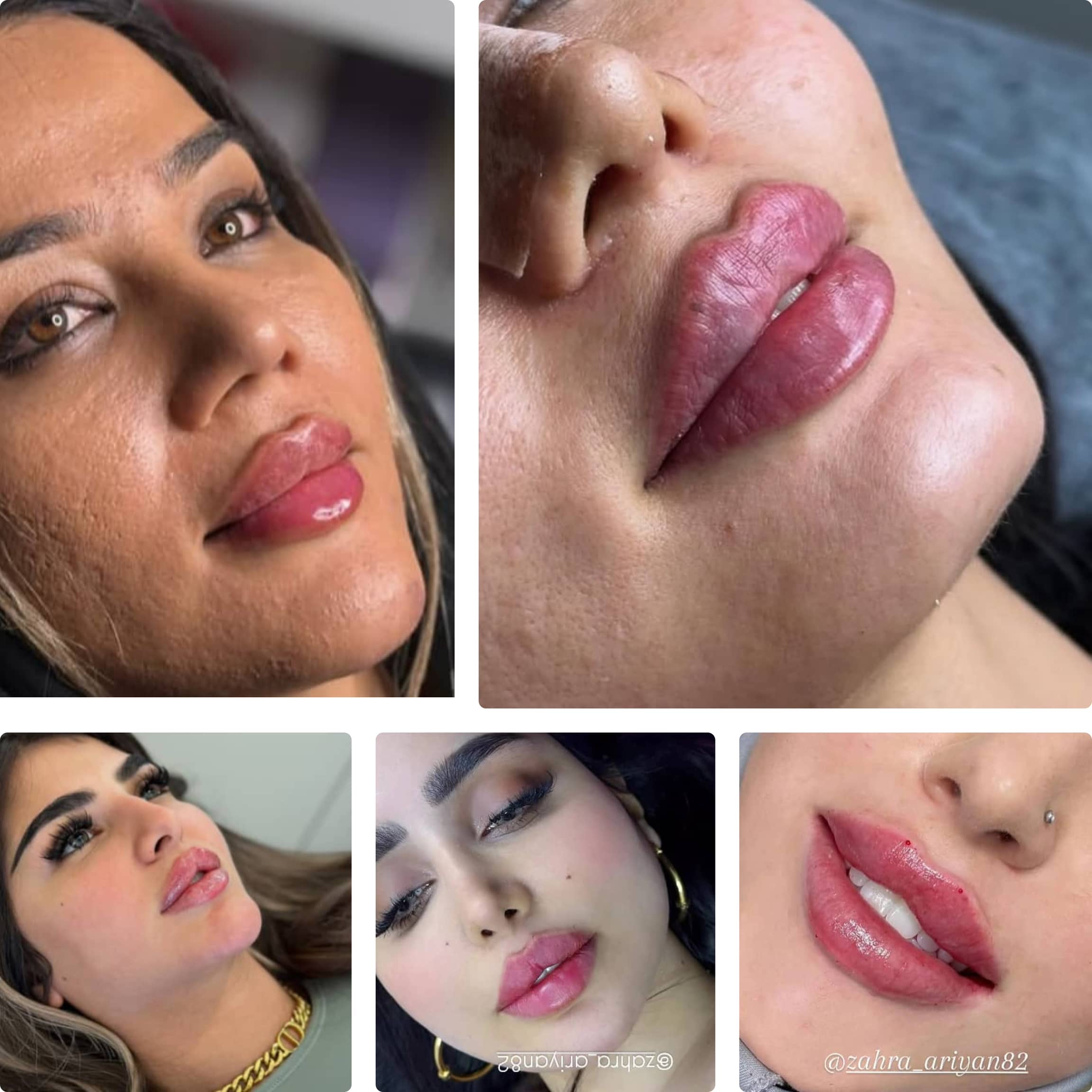 سالن ژل و بوتاکس زهرا آرین خرم آباد،سالن ژل و بوتاکس زهرا آرین در خرم آباد،مشاهده اطلاعات سالن ژل و بوتاکس زهرا آرین خرم آباد در سامانه برترین مشاغل