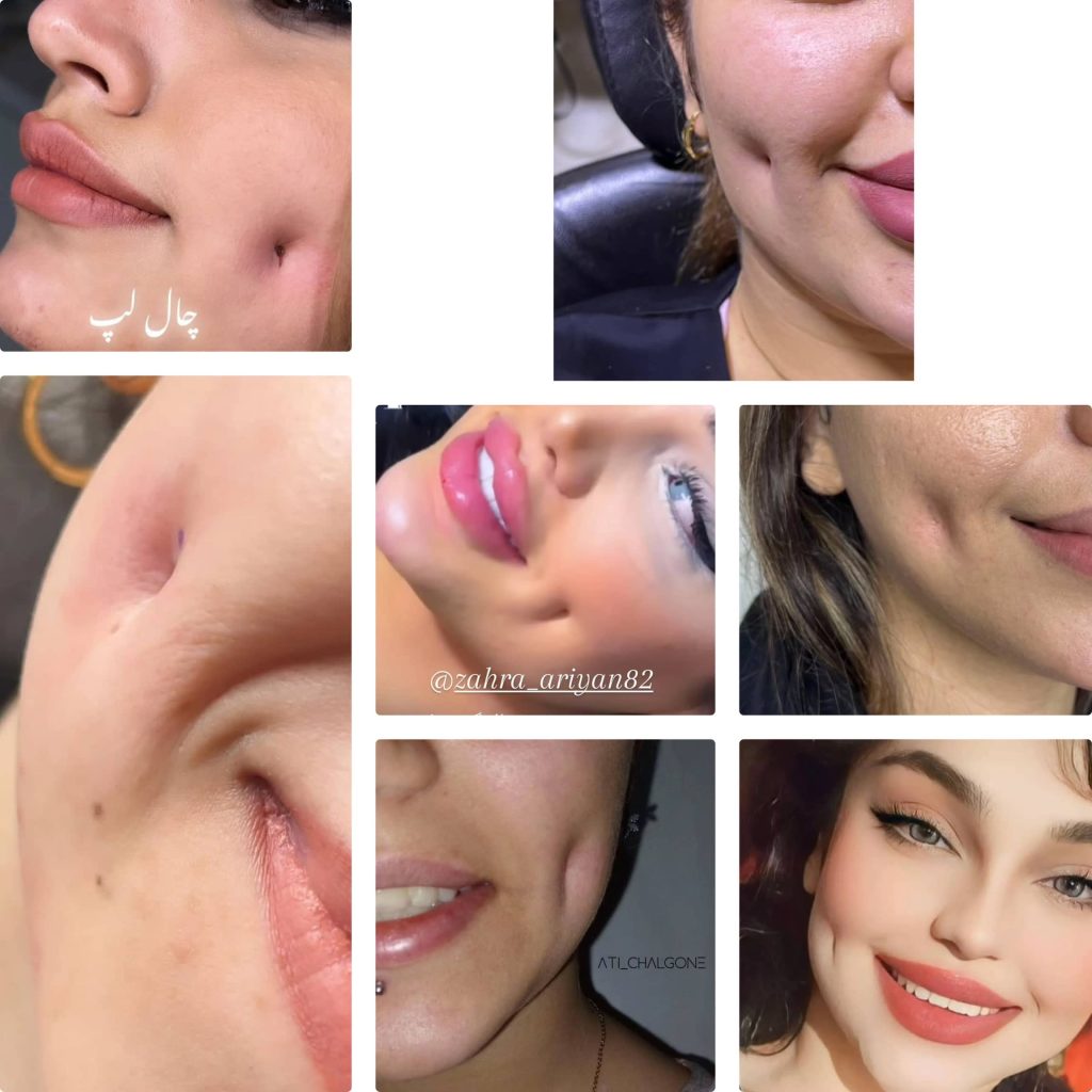 سالن ژل و بوتاکس زهرا آرین خرم آباد