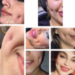 سالن ژل و بوتاکس زهرا آرین خرم آباد