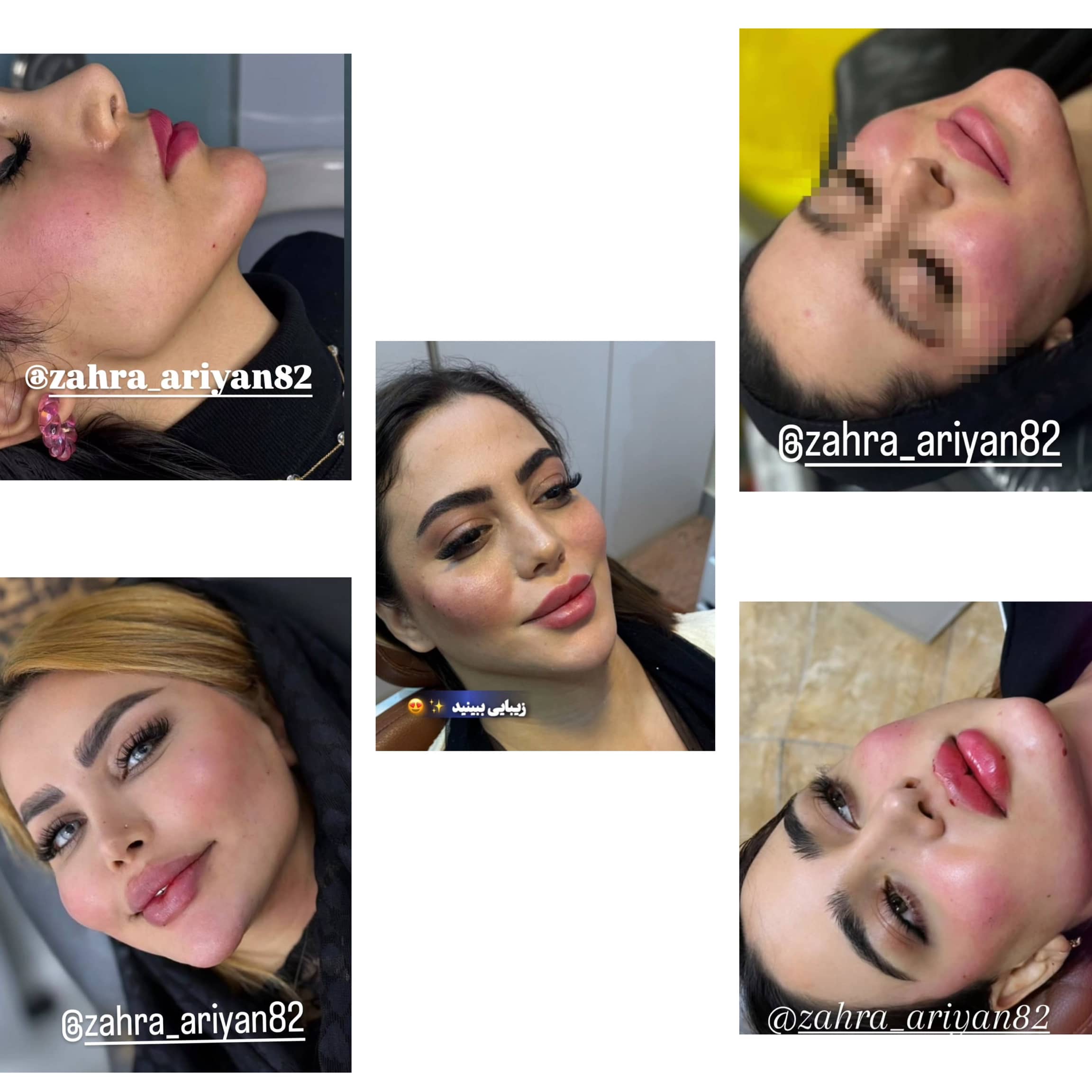 سالن ژل و بوتاکس زهرا آرین خرم آباد،سالن ژل و بوتاکس زهرا آرین در خرم آباد،مشاهده اطلاعات سالن ژل و بوتاکس زهرا آرین خرم آباد در سامانه برترین مشاغل