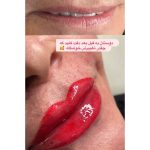 آرایشگاه زنانه طوطیان انزلی