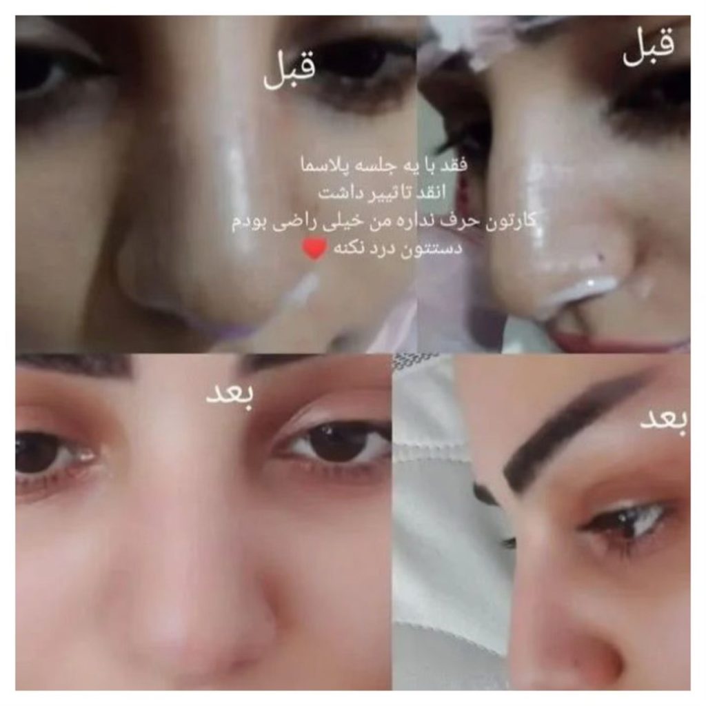 تاتو دائم افتخاری ارومیه
