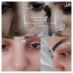 تاتو دائم افتخاری ارومیه