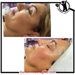 خدمات فیشیال و پاکسازی پوست الهه گنجیان ساری