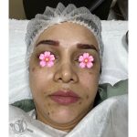 خدمات فیشیال و پاکسازی پوست الهه گنجیان ساری