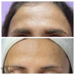 خدمات فیشیال و پاکسازی پوست الهه گنجیان ساری