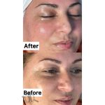 خدمات فیشیال و پاکسازی پوست الهه گنجیان ساری