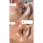 خدمات فیشیال و پاکسازی پوست الهه گنجیان ساری