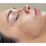 خدمات فیشیال و پاکسازی پوست الهه گنجیان ساری