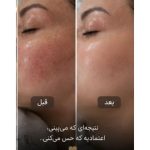 سالن زیبایی گلبرگ انزلی